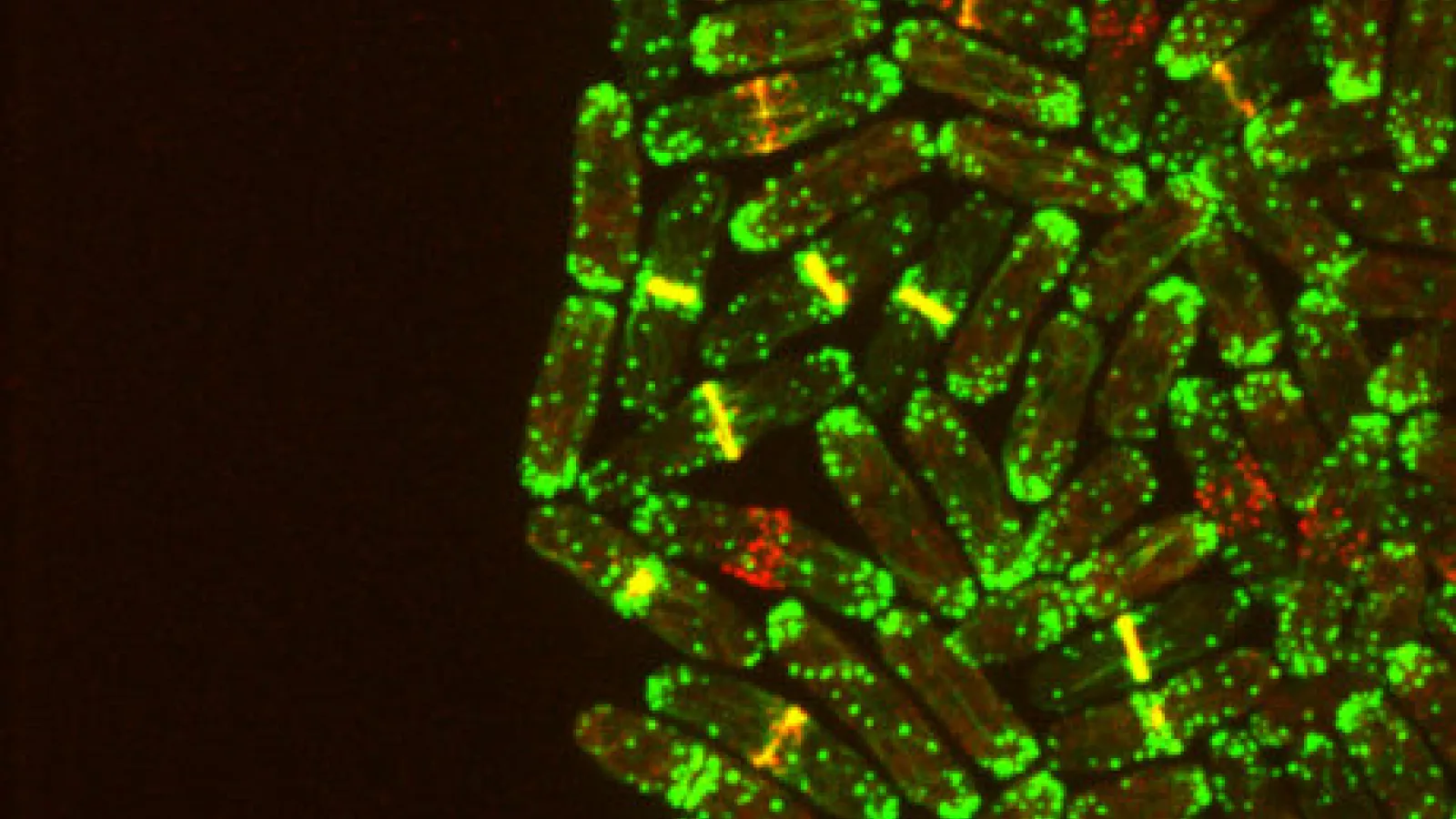 Yeast cells at 5000x magnification