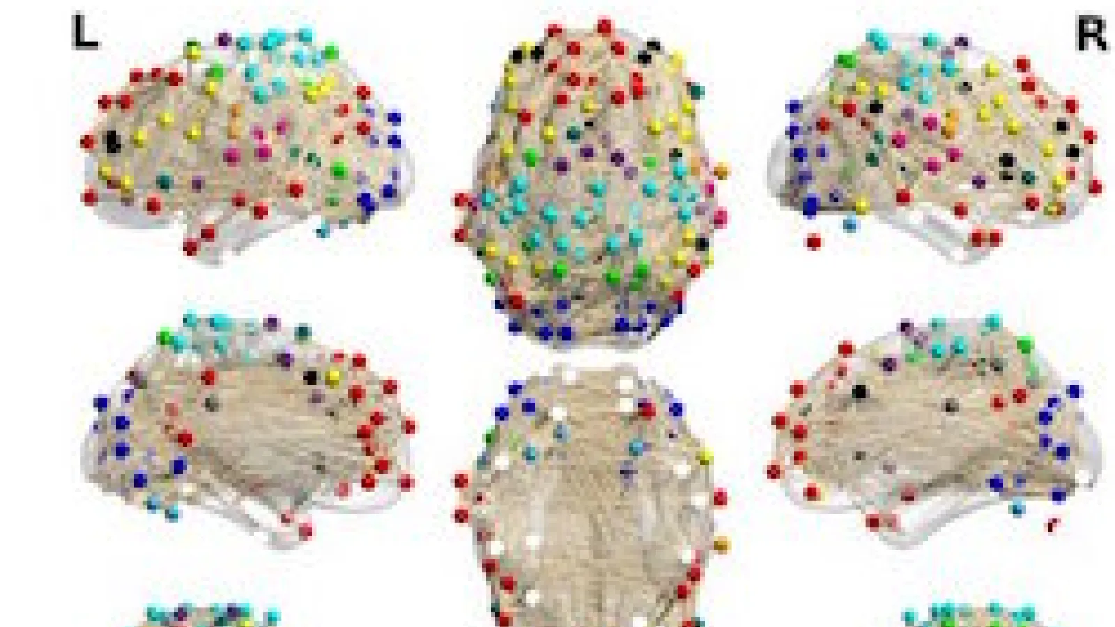 color coded dots mapping brain activity