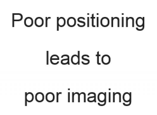 Poor positioning leads to poor imaging