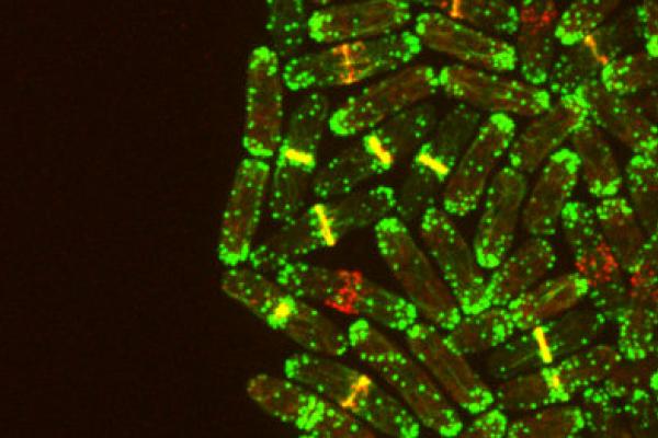 Yeast cells at 5000x magnification Yeast cells at 5000x magnification