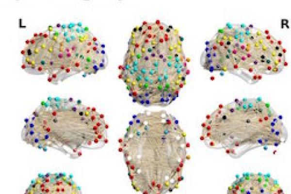 color coded dots mapping brain activity